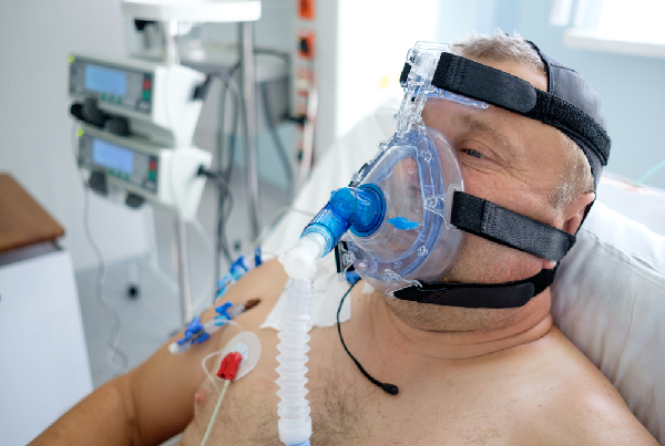 Invasive Ventilation