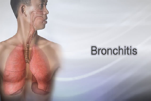 Acute Bronchitis