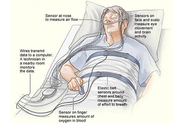 Sleep Study Test